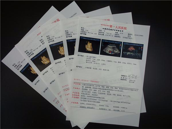 医用B超胶片 医用B超胶片